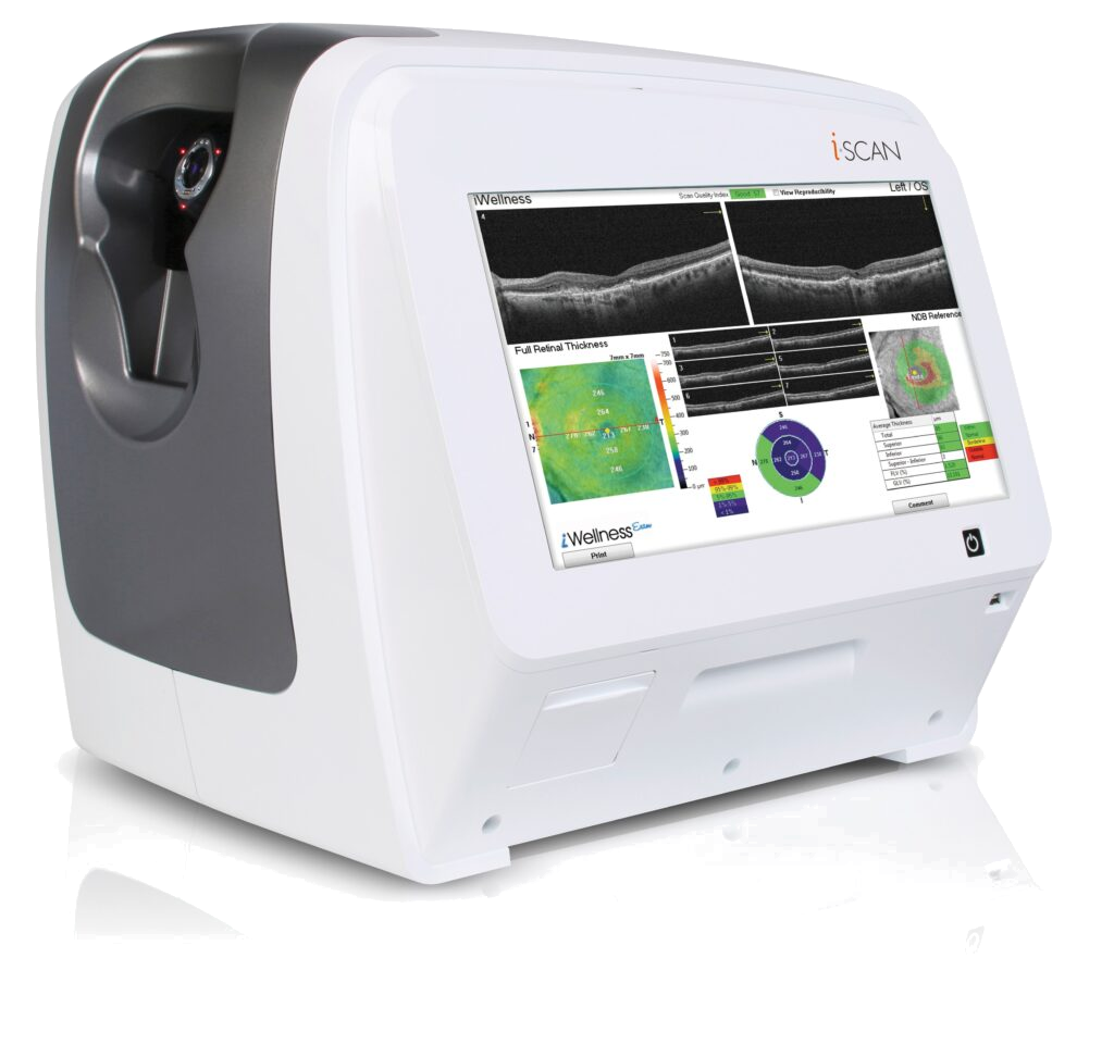 Optovue iScan80 — Visionix